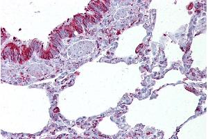 Immunohistochemistry (IHC) image for anti-gamma-aminobutyric Acid (GABA) A Receptor, beta 3 (GABRB3) (Middle Region) antibody (ABIN2776245)