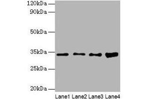Western blot All lanes: GTF2E2 antibody at 2 μg/mL Lane 1: Mouse brain tissue Lane 2: Hela whole cell lysate Lane 3: MCF-7 whole cell lysate Lane 4: PC-3 whole cell lysate Secondary Goat polyclonal to rabbit IgG at 1/10000 dilution Predicted band size: 34 kDa Observed band size: 34 kDa (GTF2E2 抗体  (AA 1-291))