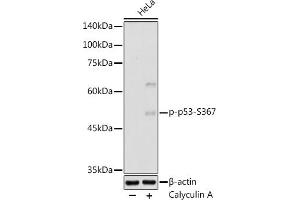 Western Blotting (WB) image for anti-Tumor Protein P53 (TP53) (pSer367) antibody (ABIN7271087)