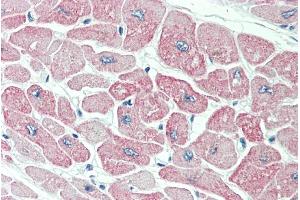 ABIN190810 (5µg/ml) staining of paraffin embedded Human Heart. (CLIC4 抗体  (N-Term))