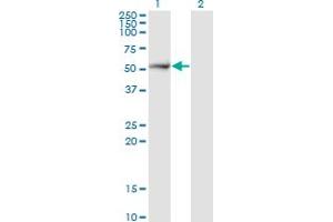 Western Blotting (WB) image for anti-Proteasome (Prosome, Macropain) 26S Subunit, Non-ATPase, 5 (PSMD5) (AA 1-504) antibody (ABIN519401)