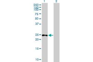 Western Blot analysis of SAMD4A expression in transfected 293T cell line by SAMD4A MaxPab polyclonal antibody. (SAMD4A 抗体  (AA 1-247))