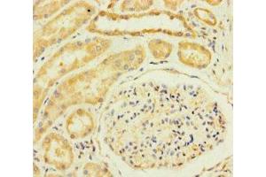 Immunohistochemistry of paraffin-embedded human kidney tissue using ABIN7172224 at dilution of 1:100 (TM2D3 抗体  (AA 31-153))