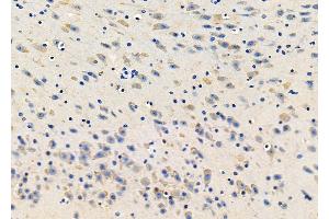 ABIN6265432 and ABIN6278417 at 1/100 staining Mouse brain tissue by IHC-P. (TACR2 抗体  (C-Term))