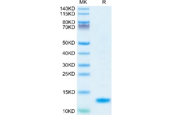 IL-8 Protein (AA 28-99) (His tag)