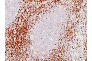 Formalin-fixed, paraffin-embedded human Tonsil stained with CD5 Mouse Monoclonal Antibody (C5/473 + CD5/54/F6) (CD5 抗体)