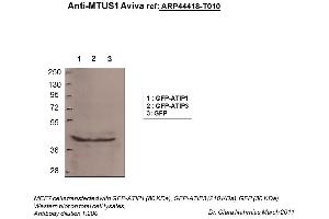 Image no. 2 for anti-Microtubule Associated Tumor Suppressor 1 (MTUS1) (N-Term) antibody (ABIN2781854) (MTUS1 抗体  (N-Term))