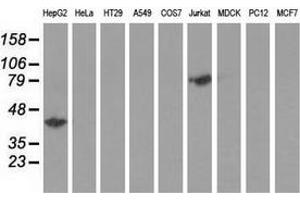 Western blot analysis of extracts (35 µg) from 9 different cell lines by using anti-HP monoclonal antibody. (Haptoglobin 抗体)