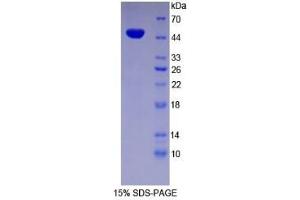 SDS-PAGE of Protein Standard from the Kit  (Highly purified E. (ENO2/NSE ELISA 试剂盒)