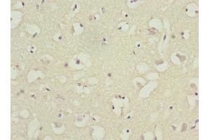 Immunohistochemistry of paraffin-embedded human brain tissue using ABIN7145556 at dilution of 1:100 (BFAR 抗体  (AA 1-140))