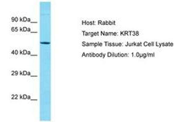 KRT38 抗体  (AA 94-143)