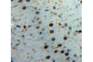 Used in DAB staining on fromalin fixed paraffin-embedded Brain tissue (IL-33 抗体  (AA 1-270))