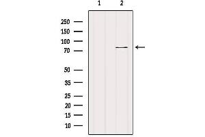 Western Blotting (WB) image for anti-Carnitine Palmitoyltransferase 1C (CPT1C) antibody (ABIN6261010)