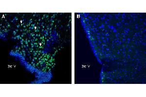 Expression of C3aR1 in mouse hypothalamus. (C3AR1 抗体  (Extracellular))