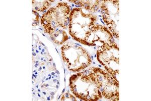 (ABIN390207 and ABIN2840690) staining DDIT4 in human kidney tissue sections by Immunohistochemistry (IHC-P - paraformaldehyde-fixed, paraffin-embedded sections).