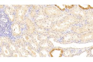Detection of LAMb3 in Human Kidney Tissue using Polyclonal Antibody to Laminin Beta 3 (LAMb3) (Laminin beta 3 抗体  (AA 352-587))