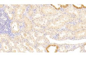 Detection of LAMb3 in Human Kidney Tissue using Polyclonal Antibody to Laminin Beta 3 (LAMb3) (Laminin beta 3 抗体  (AA 352-587))