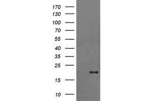 Image no. 2 for anti-Fetal and Adult Testis Expressed 1 (FATE1) antibody (ABIN1498226) (FATE1 抗体)