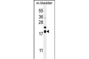 F162A Antibody (C-term) (ABIN654943 and ABIN2844584) western blot analysis in mouse bladder tissue lysates (35 μg/lane). (F162A 抗体  (C-Term))