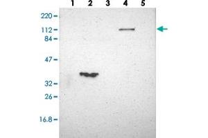 Western blot analysis of Lane 1: RT-4, Lane 2: U-251 MG, Lane 3: Human Plasma, Lane 4: Liver, Lane 5: Tonsil with FAM65A polyclonal antibody  at 1:250-1:500 dilution. (FAM65A 抗体)