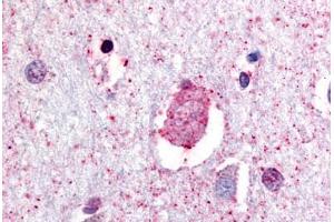 Anti-GPR88 antibody  ABIN1048892 IHC staining of human brain, neurons and glia.