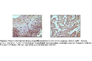 Image no. 1 for anti-Retinoblastoma Protein (Rb Protein) antibody (ABIN205594) (Retinoblastoma Protein (Rb) 抗体)