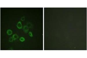 Immunofluorescence analysis of HuvEc cells, using Bax (Ab-167) Antibody. (BAX 抗体  (AA 133-182))