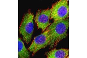 Fluorescent confocal image of C2C12 cell stained with AKT2 Antibody  (ABIN391024 and ABIN2841194). (AKT2 抗体  (AA 452-481))