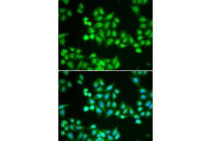 Immunofluorescence analysis of HeLa cells using CHD2 antibody. (CHD2 抗体)