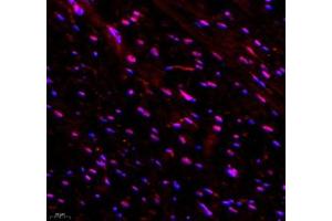 Immunofluorescence of paraffin embedded rat heart using TYW1B (ABIN7076025) at dilution of 1: 650 (400x lens)