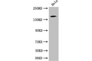 Western Blot Positive WB detected in: Hela whole cell lysate All lanes: TNRC6C antibody at 3. (TNRC6C 抗体  (AA 157-421))