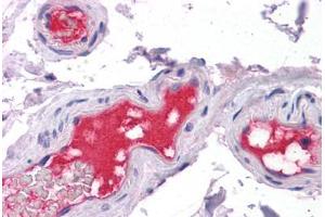 Vessels, Human: Formalin-Fixed, Paraffin-Embedded (FFPE) (PROC 抗体)