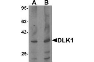 Western blot analysis of HepG2 in 293 cell lysate with DLK1 Antibody  at (A) 1 and (B) 2 μg/ml. (DLK1 抗体  (C-Term))