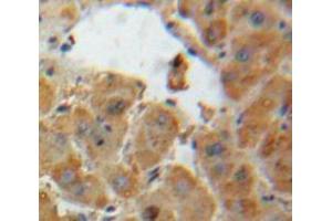 IHC-P analysis of Liver tissue, with DAB staining. (AGT 抗体  (AA 25-477))