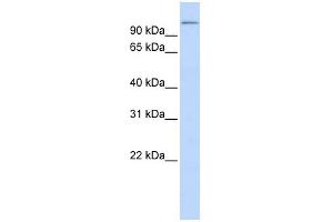 TXNDC16 antibody used at 1 ug/ml to detect target protein. (TXNDC16 抗体  (N-Term))