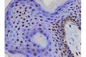 Immunohistochemistry (IHC) image for anti-Cofilin 1 (CFL1) (pSer3) antibody (ABIN6255180)