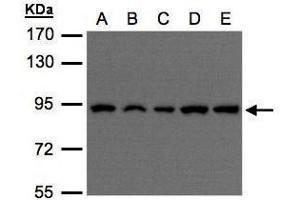 WB Image Sample(30 μg of whole cell lysate) A:H1299 B:HeLa S3 , C:Hep G2 , D:MOLT4 , E:Raji , 7. (VPS35 抗体  (C-Term))