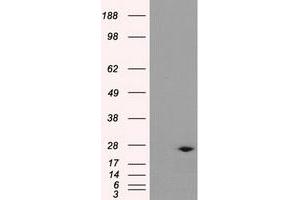 Western Blotting (WB) image for anti-Dicarbonyl/L-Xylulose Reductase (DCXR) antibody (ABIN1497787) (DCXR 抗体)