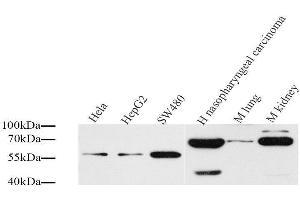 Western Blot analysis of various samples using CD54 Polyclonal Antibody at dilution of 1:1000. (ICAM1 抗体)