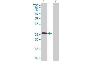 Lane 1: SNRPN transfected lysate ( 26. (SNRPN 293T Cell Transient Overexpression Lysate(Denatured))