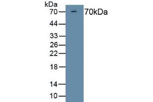 Detection of Recombinant HDAC1, Mouse using Polyclonal Antibody to Histone Deacetylase 1 (HDAC1) (HDAC1 抗体  (AA 1-482))