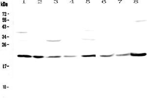 Western blot analysis of GLO1 using anti-GLO1 antibody . (GLO1 抗体  (AA 2-184))