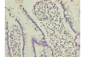 Immunohistochemistry of paraffin-embedded human small intestine tissue using ABIN7162226 at dilution of 1:100 (PLAC1L 抗体  (AA 74-158))