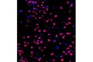 Immunofluorescence of paraffin embedded mouse brain using NAIF1 (ABIN7074867) at dilution of 1:650 (400x lens) (NAIF1 抗体)