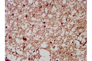 IHC image of ABIN7161362 diluted at 1:200 and staining in paraffin-embedded human brain tissue performed on a Leica BondTM system. (NrCAM 抗体  (AA 1194-1299))