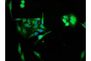 Immunofluorescence staining of Hela cells with ABIN7155861 at 1:66, counter-stained with DAPI. (HIPK1 抗体  (AA 1007-1151))
