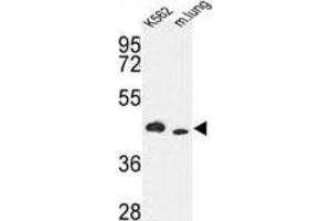 Western Blotting (WB) image for anti-Inositol-Trisphosphate 3-Kinase A (ITPKA) antibody (ABIN3003733) (ITPKA 抗体)