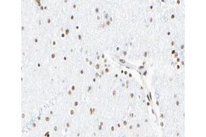 ABIN6267065 at 1/100 staining human Brain tissue sections by IHC-P. (Histone 3 抗体  (H3K18ac))