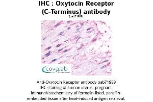 Image no. 1 for anti-Oxytocin Receptor (OXTR) (C-Term), (Cytoplasmic Domain) antibody (ABIN1737738) (Oxytocin Receptor 抗体  (C-Term, Cytoplasmic Domain))
