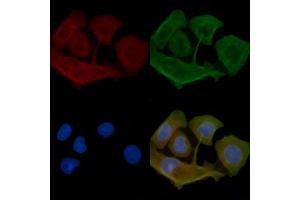 ABIN6262852 and ABIN6277515 staining Hela cells(45 min of heat-shock) by IF/ICC.